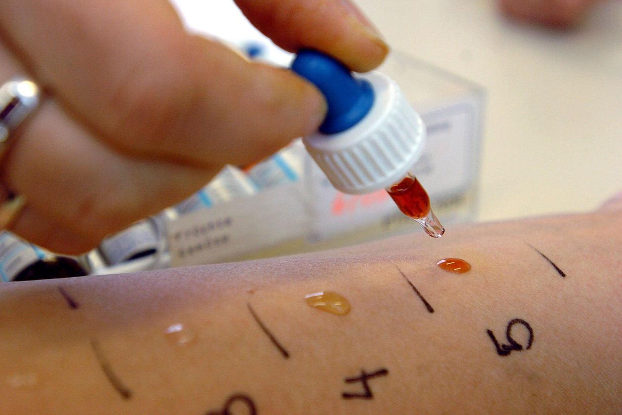 Сдать анализ крови на аллергию в нижнем новгороде thumbnail